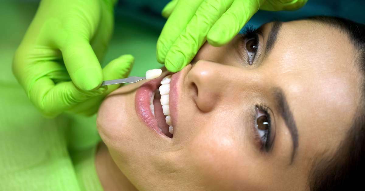 A dentist holds up sealant next to the teeth in a woman's mouth to compare the colors and see if they match.