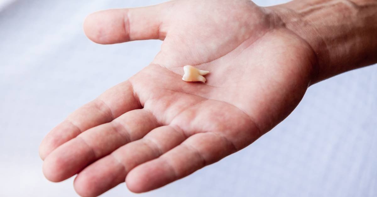 Close-up of a human hand holding a small tooth in its palm. It is positioned against a white background.