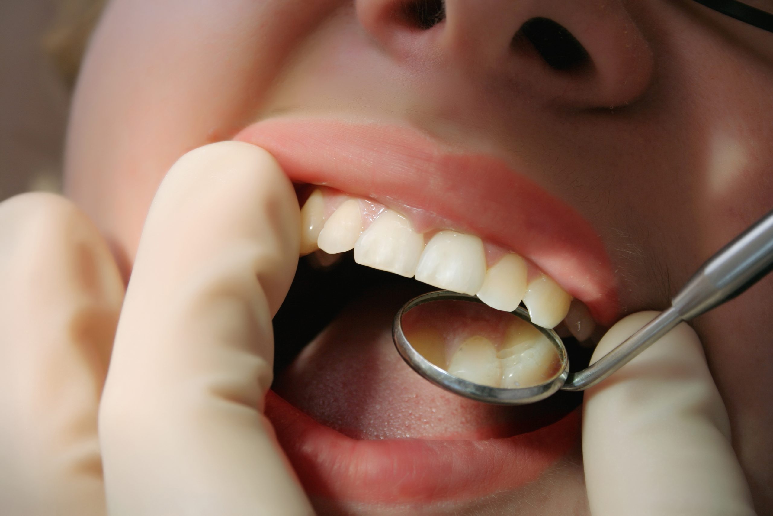 A dentist's hands hold a mirror in a patient's mouth as they try to look at the back of their teeth and gums.