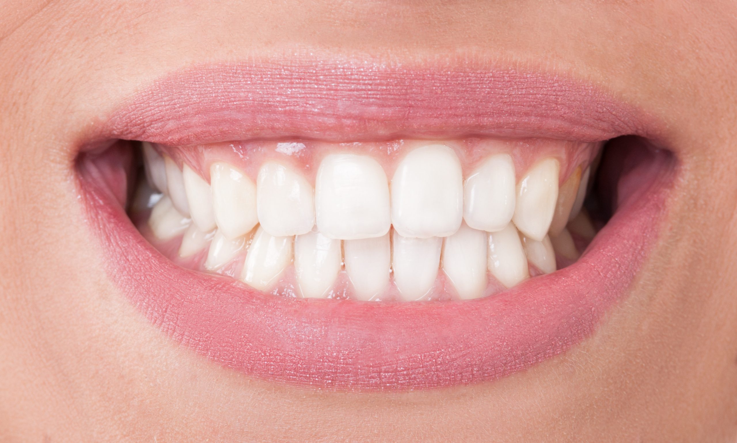 Close-up of a woman's smile as she shows off perfect teeth on the upper and lower jaw. Her lips are pink.