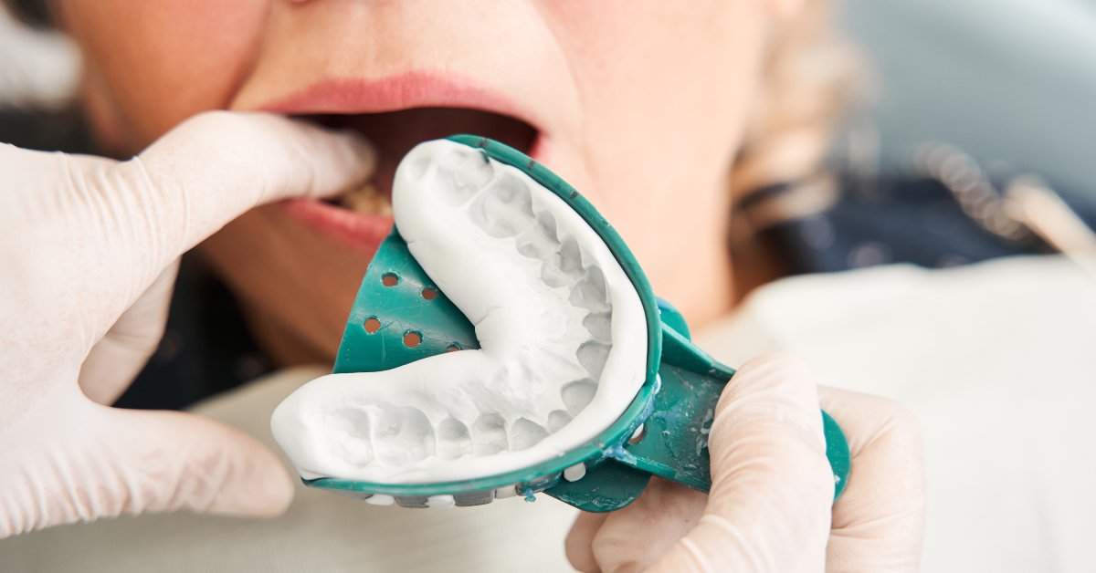 A close-up of a dentist's hands about to put a dental impression into a patient's mouth. The dentist wears white gloves.